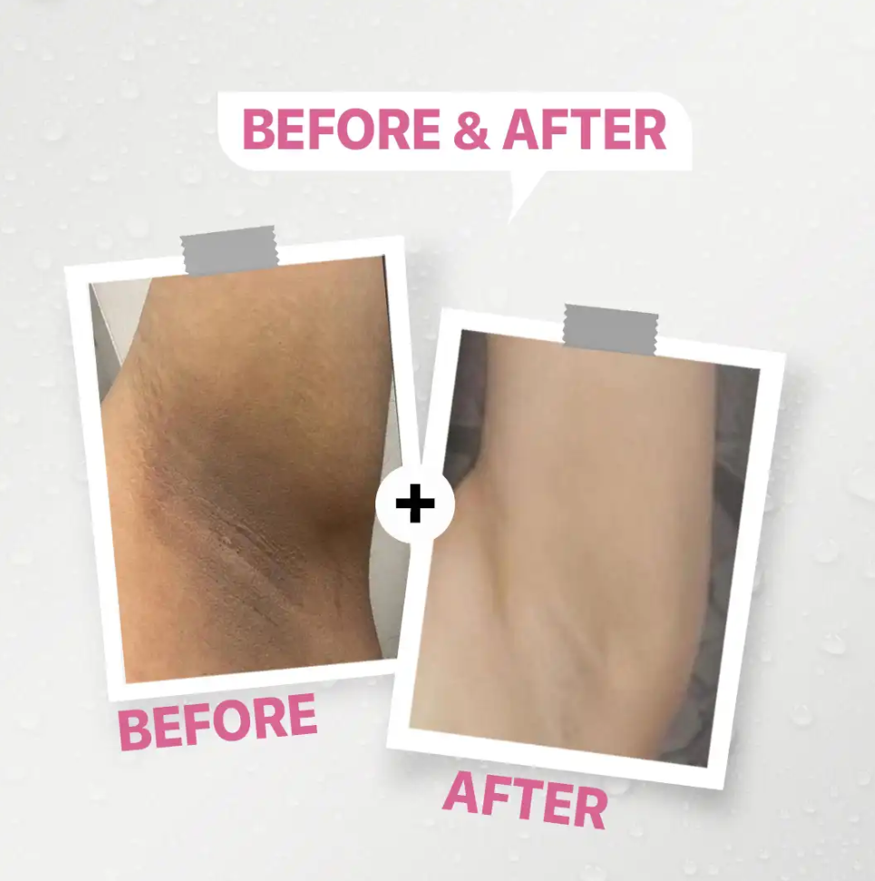 Daky Sensitive Whitening Cream 50gm