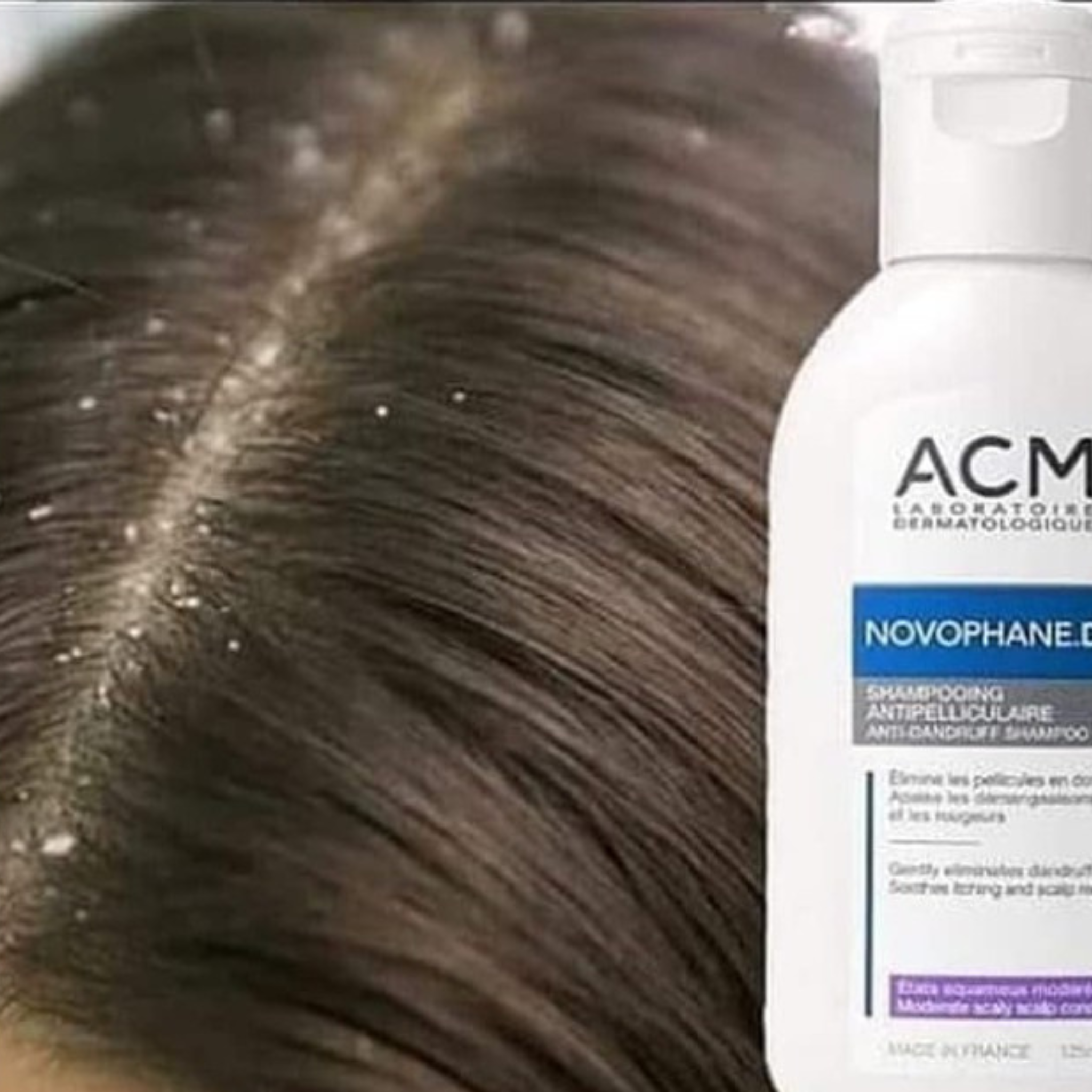 ACM Novophane DS Shampoo 125ml