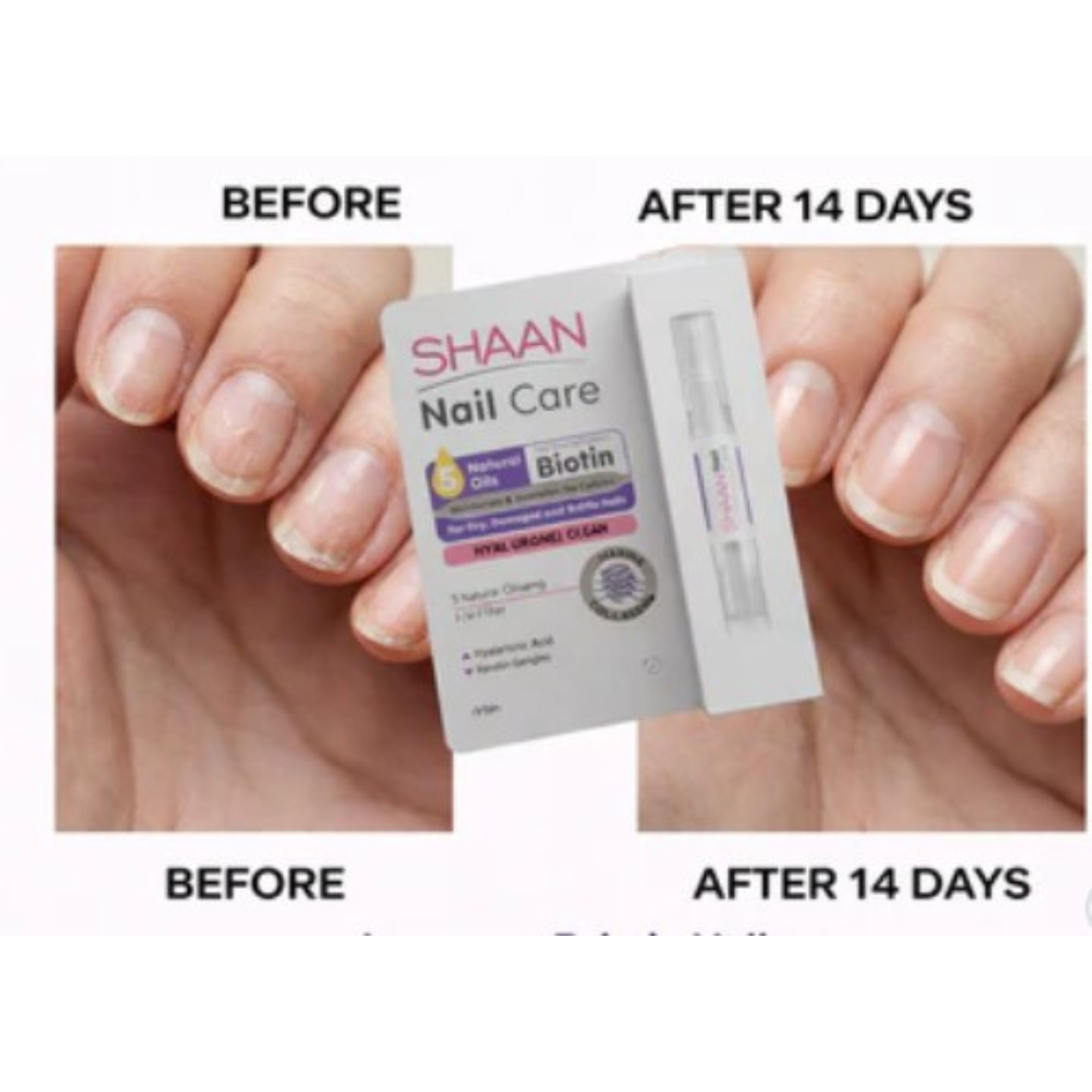 Shaan Nail Care 4ml
